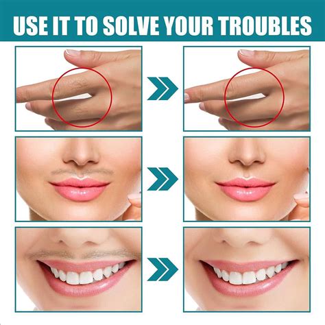 Skinetic Peach Fuzz Hair Removal Cream - Gentle Facial Hair Remover for ...