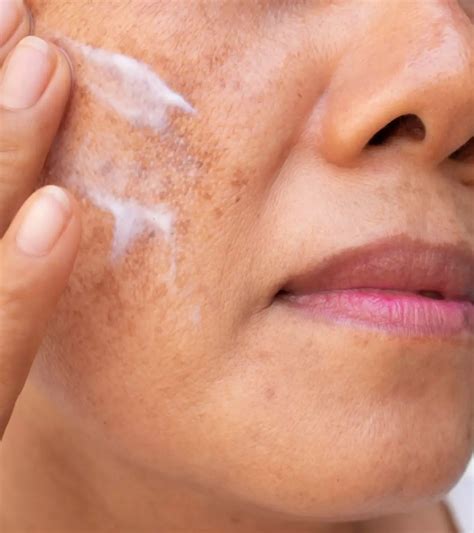 Vomiting Blood During Pregnancy: What You Need To Know