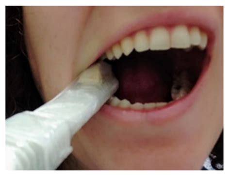 Maximal Bite Force Measured via Digital Bite Force Transducer in ...