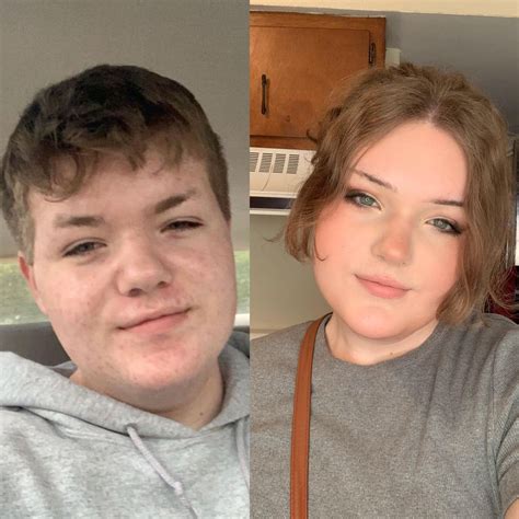 left is 1yr 6m before | right is 10m HRT + weight loss : r/transtimelines