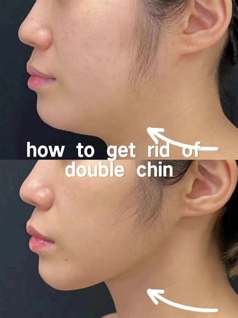 double chin exercise [Video] | Double chin exercises, Chin exercises, Reduce double chin