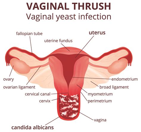 Women's Health Issues