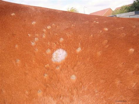 Beginning Stages Of Ringworm