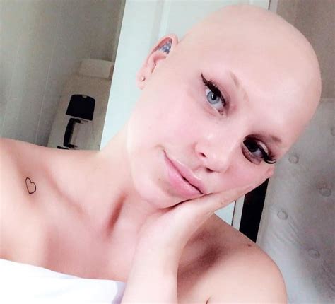 My hair fell out so my boyfriend spent 4 years growing a 2ft mane for a wig, we'd only been ...