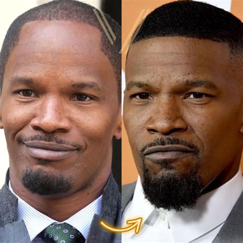 Jamie Foxx Hair Before And After