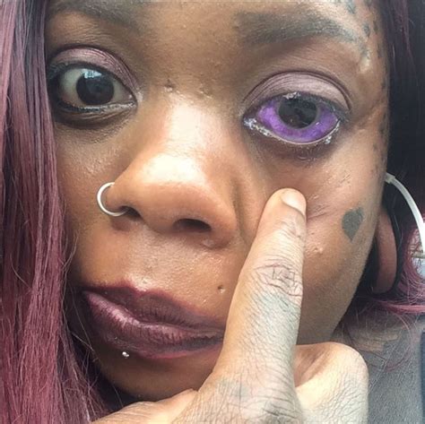 Mother-of-five going blind after tattooing her eyeball purple ...