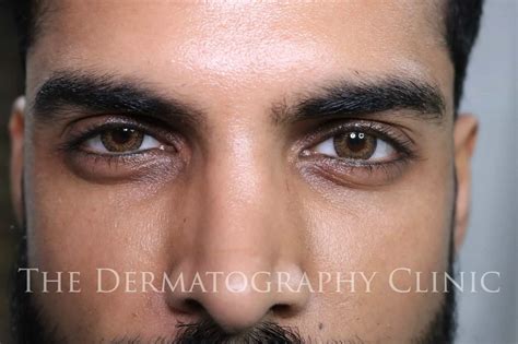Permanent Makeup Eyeliner & Lashline Tattoo For Men