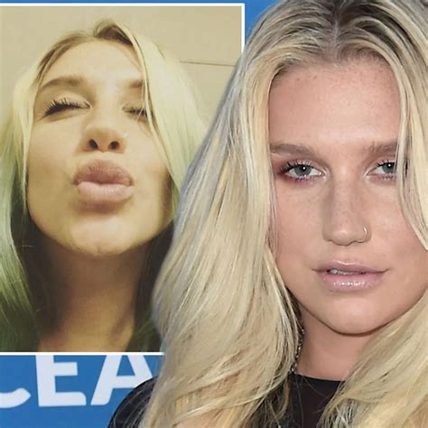 Kesha Before And After Nose Job