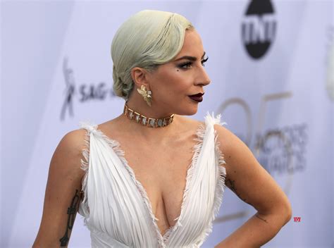 Lady Gaga almost had 'entire body' X-rayed after stage fall - Social ...