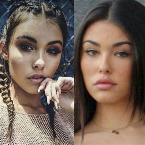 Madison Beer plastic surgery | Eyebrow lift, Cheek fillers, Eye surgery