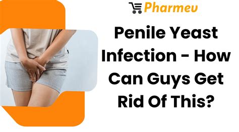 Penile Yeast Infection - How Can Guys Get Rid Of This? - Pharmev - sex with yeast