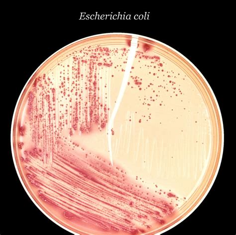 45+ Escherichia coli imágenes gratis