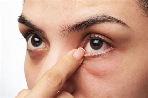 Eye Twitch During Pregnancy: Causes and Remedies