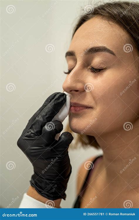 Young Beautiful Girl Came To the Salon To Get Rid of the Lump Above the Upper Lip. Stock Image ...