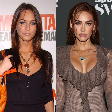Megan Fox Before And After Plastic Surgery 2022