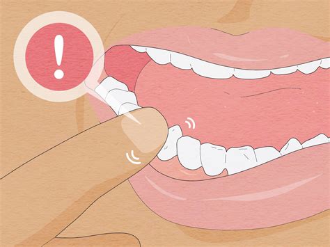 12 Formas de Extrair um Dente em Casa - wikiHow