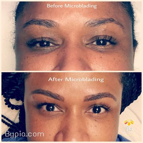Fixing uneven eyebrows with Microblading | Uneven eyebrows ...