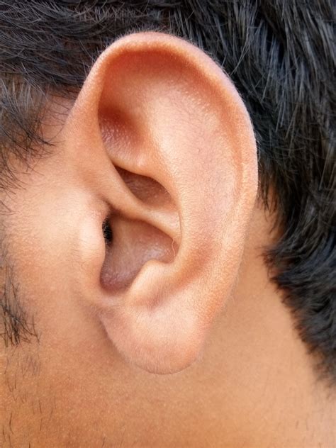 Seborrheic Eczema In Ear