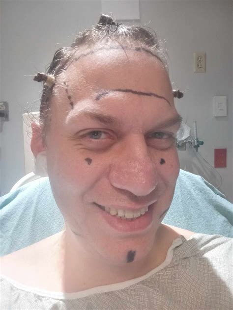 I Showered for the First & Third Times Since Gender-Affirming Breast Surgery. They Were Two of ...