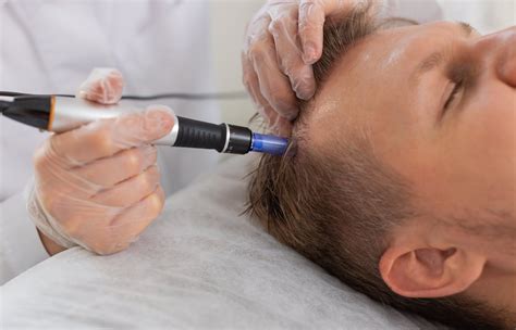 Microneedling – Chatham Skin Clinic