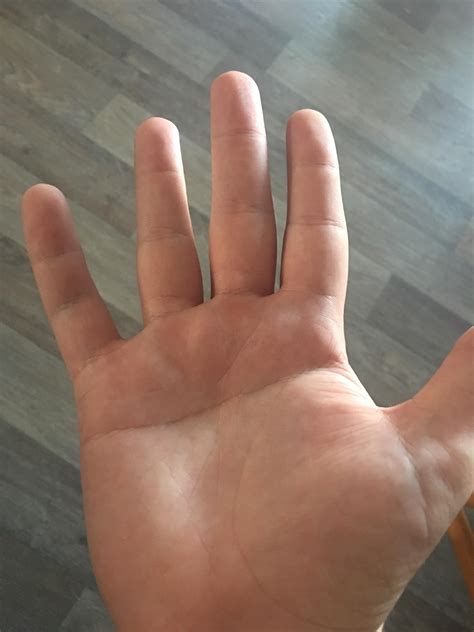 I have a single transverse palmar crease which is a single crease that ...