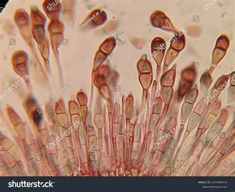 Microscopic Images Of Plant Cells