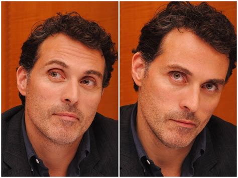 Rufus Sewell Lazy Eye