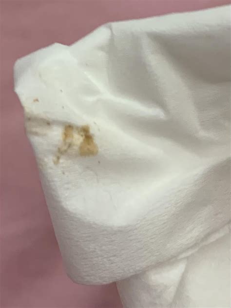 Is my cats red/brown eye discharge normal? : r/CATHELP