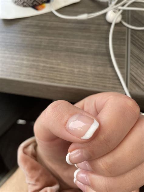 Will my proximal nail fold reattach? Salon drilled it off : r ...