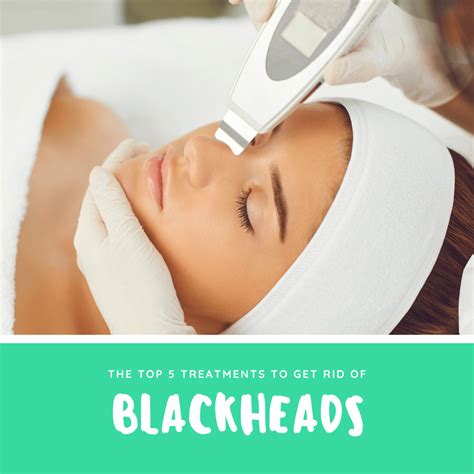 The Top 5 Treatments to Get Rid of Blackheads | Annapolis and Severna Park, MD
