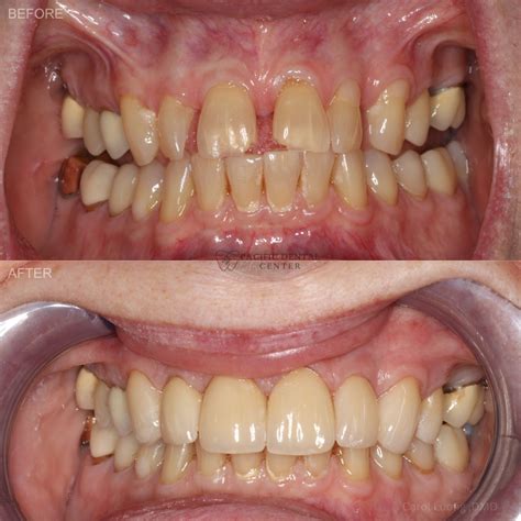 Smile Gallery - Pacific Dental Center