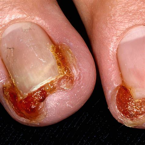 Quick Tips for Identifying and Fixing Nail Problems