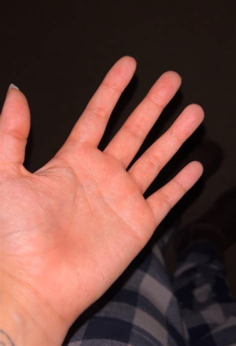 blood pooling? : r/POTS