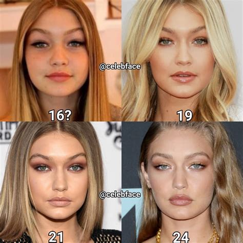 Bella Hadid Before - Did Bella Hadid Get Plastic Surgery She Denies Nose Job Fillers Hollywood ...