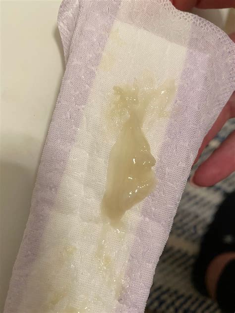 What Does A Mucus.plug Look Like at Aaron Reese blog