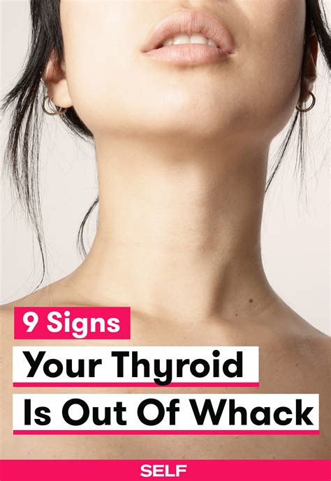 9 Signs Your Thyroid Is Out Of Whack | Symptoms of thyroid problems, Enlarged thyroid symptoms ...