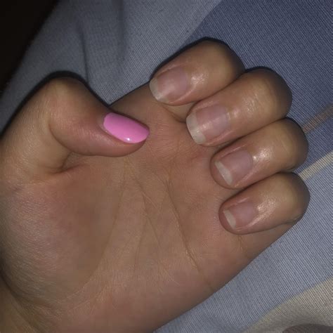 1 month growth with ski slope nails! Gel polish started lifting so I ...