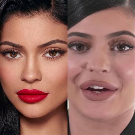 BeforeAfter on Instagram: "INSTAGRAM VS REALITY KYLIE JENNER # ...