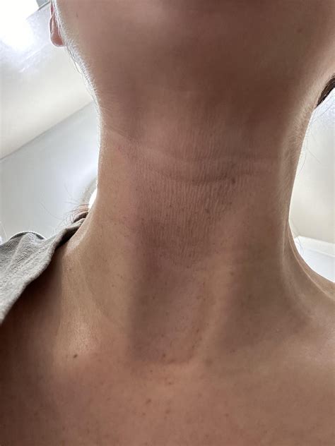 Loose, wrinkly skin on my neck. How do I get rid of it? : r/30PlusSkinCare