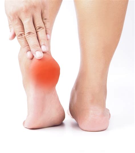 Heel Pain And Burning