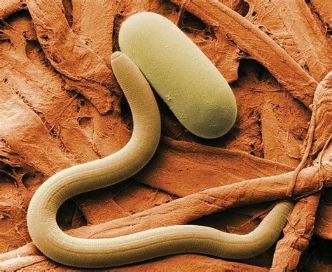 Didinium | ciliate genus | Britannica