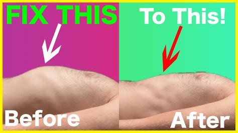 Rib Flare – FIX It for Good – ZacCupples.com