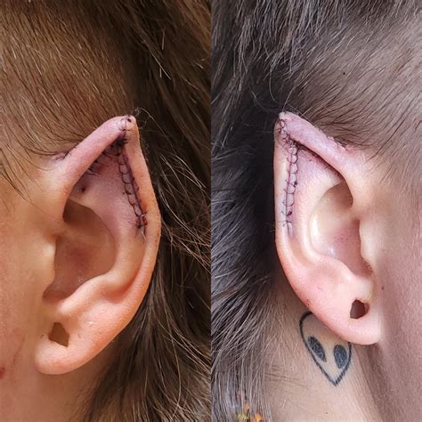 Ear Pointing