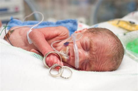 {Professional Insight} Documenting Your Baby’s NICU Journey Through Photography - Preemie Babies ...