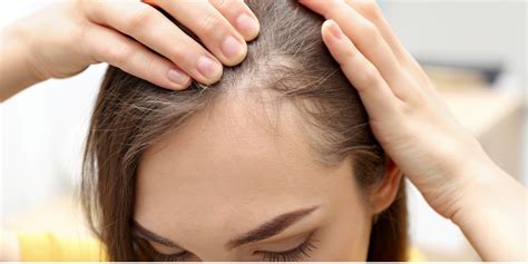 Alopecia Treatments | San Luis Obispo | Coastal Dermatology
