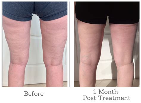 Step-by-Step Wedding Prep For Your Skin - Supriya Dermatology