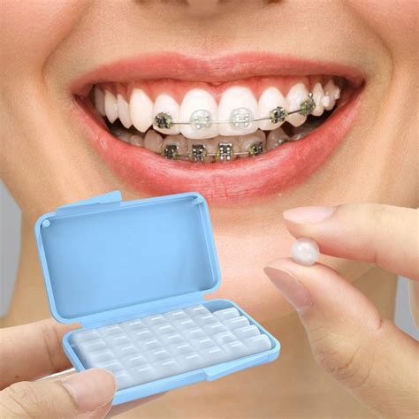 Orthodontic Wax For Broken Tooth at Daniel Christie blog