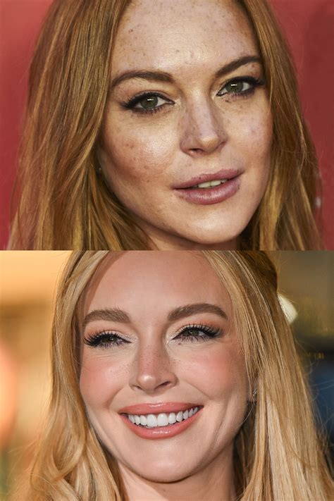 How to Get Rid of Freckles: What Causes Them & How to Treat or Embrace Them