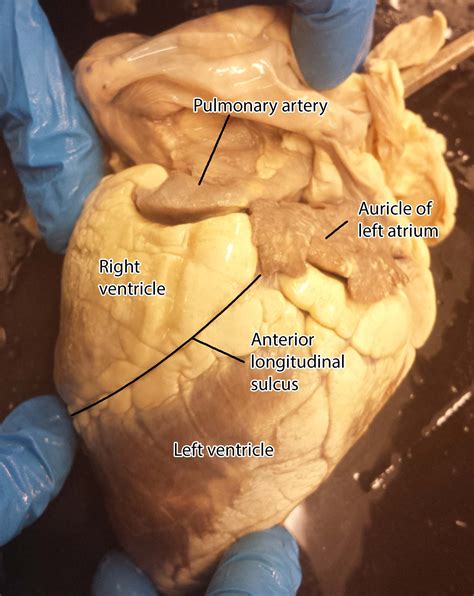 Real Heart Pictures Labeled
