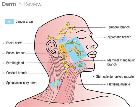 It's Mnemonic Monday! To Zanzibar By Motor Car - Next Steps in Dermatology